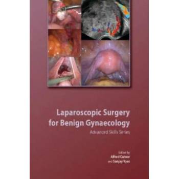Image 1 of Laparoscopic Surgery for Benign Gynaecology Hardback with DVDs | Alfred CutnerSanjay Vyas