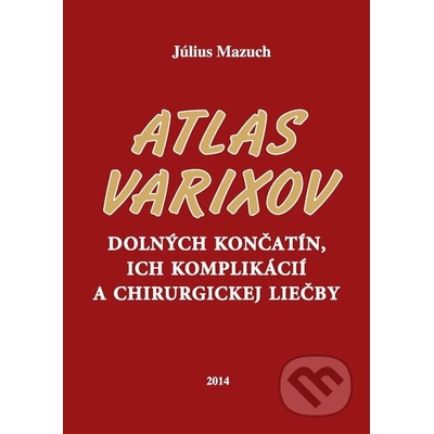 Atlas varixov dolných končatín, ich komplikácií a chirurgickej liečby - Július Mazuch