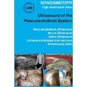SONOANATOMY - High-Resolution Atlas - Ultrasound of the Musculoskeletal System (ISBN: 9783769309133)