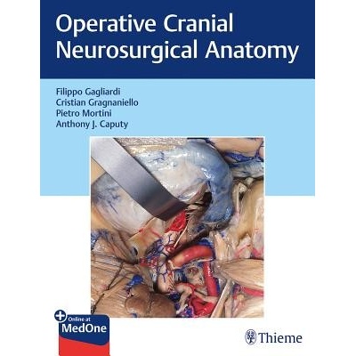 Operative Cranial Neurosurgical Anatomy Gagliardi FilippoPevná vazba