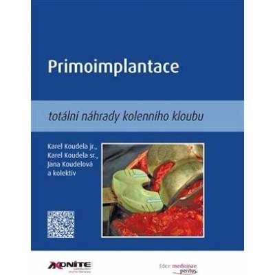 Primoimplantace totální náhrady kolenního kloubu