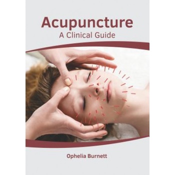 Acupuncture A Clinical Guide