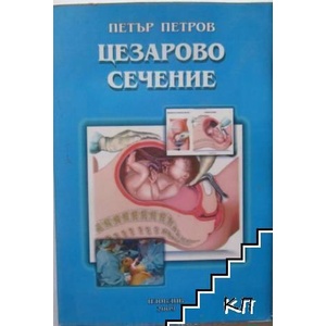 Цезарово сечение (ISBN: 9789548033053)