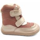 Protetika s membránou nut pink