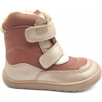 Protetika s membránou nut pink