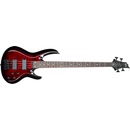 ESP LTD B-204DX