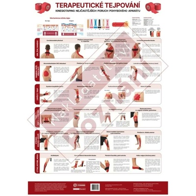 Plakát Terapeutické tejpování 70 x 48cm