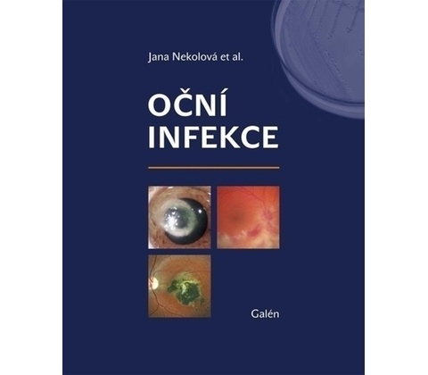 Oční infekce