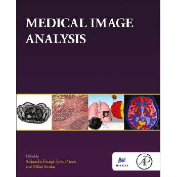 Medical Image Analysis | Alejandro F. Frangi, Jerry L. Prince, Milan Sonka