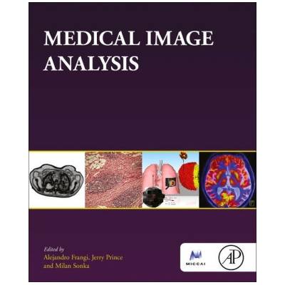 Medical Image Analysis | Alejandro F. Frangi, Jerry L. Prince, Milan Sonka