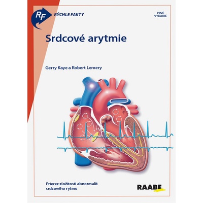 Srdcové arytmie - Gerry Kaye; Robert Lemery
