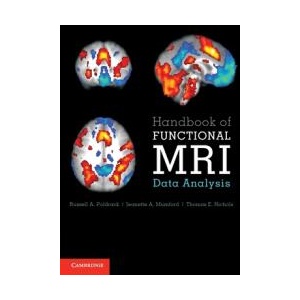 Handbook of Functional MRI Data Analysis | Russell A. Poldrack, Jeanette A. Mumford, Thomas E. Nichols (ISBN: 9781009481168)