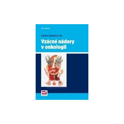 Vzácné nádory v onkologii - Kateřina Kubáčková - 2015