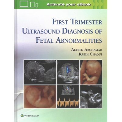 First Trimester Ultrasound Diagnosis of Fetal Abnormalities Abuhamad Alfred Z.
