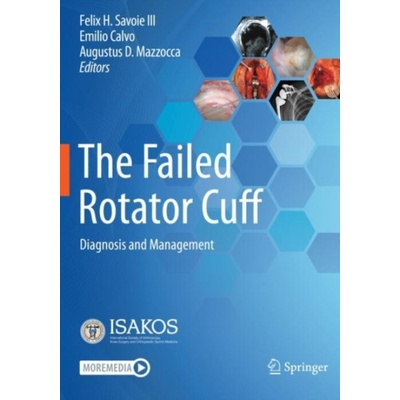Failed Rotator Cuff