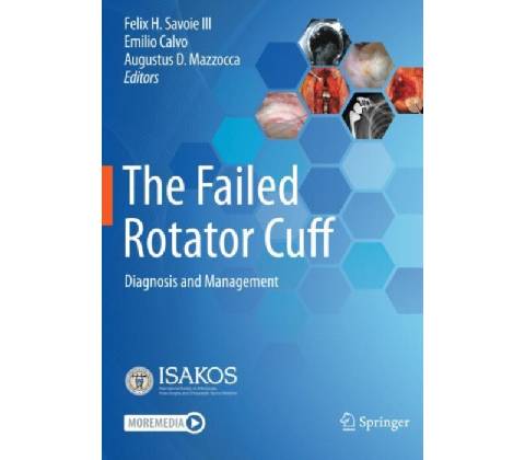 Failed Rotator Cuff