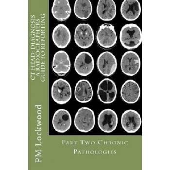 CT Head: DIAGNOSIS A Radiographers Guide To Reporting Part 2 Chronic Pathologies: Part 2 Chronic Pathologies | P M Lockwood