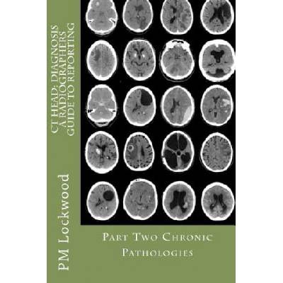CT Head: DIAGNOSIS A Radiographers Guide To Reporting Part 2 Chronic Pathologies: Part 2 Chronic Pathologies | P M Lockwood