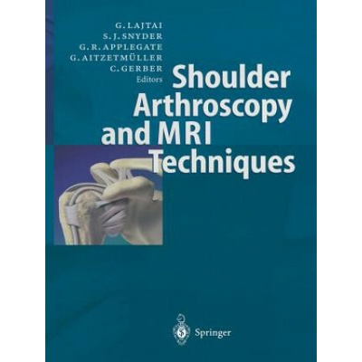 Shoulder Arthroscopy and MRI Techniques Lajtai GeorgPaperback