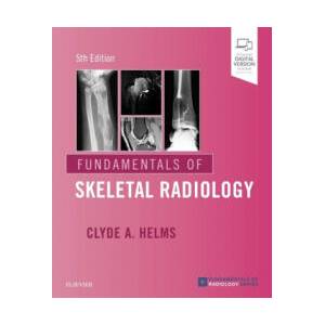 Fundamentals of Skeletal Radiology | Clyde Helms (ISBN: 9780323611657)
