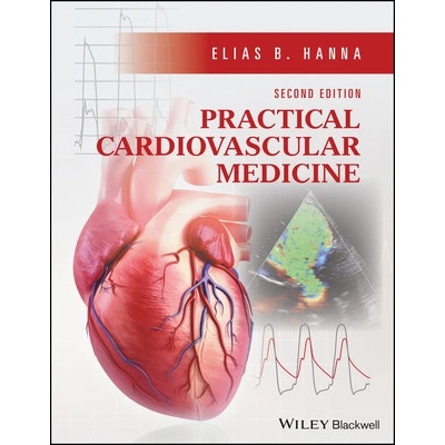 Practical Cardiovascular Medicine Hanna Elias B.