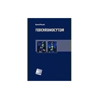 Feochromocytom - Karel Pacák