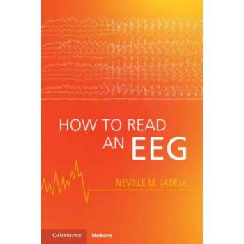 How to Read an EEG
