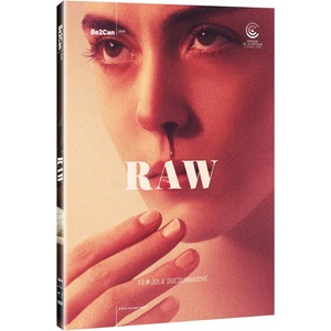 MagicBox Raw - DVD (030781)