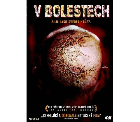 V bolestechQ DVD