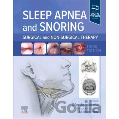 Sleep Apnea and Snoring - Ofer, MD, PhD, FAASM, FAAOA Jacobowitz