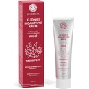 Epiderma bioaktivní CBD krém při Akné 30 ml