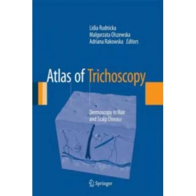 Atlas of Trichoscopy | Lidia Rudnicka, Malgorzata Olszewska, Adriana Rakowska