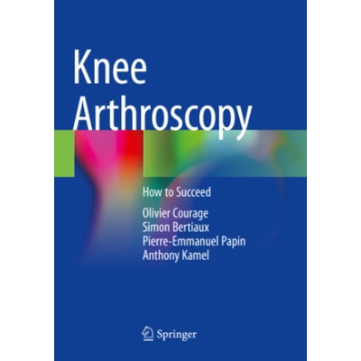 Knee Arthroscopy