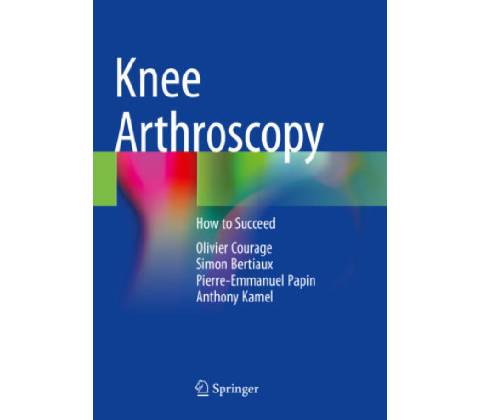 Knee Arthroscopy