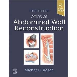 Atlas of Abdominal Wall Reconstruction | Michael J. Rosen (ISBN: 9780443118500)
