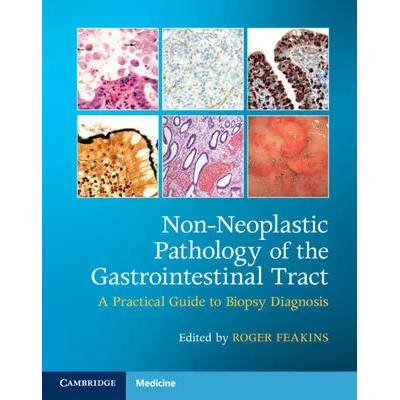 Non-Neoplastic Pathology of the Gastrointestinal Tract with Online Resource | Roger Feakins