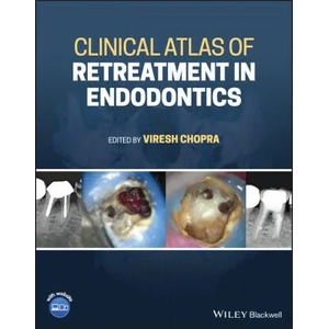Clinical Atlas of Retreatment in Endodontics | Viresh Chopra (ISBN: 9781119509202)