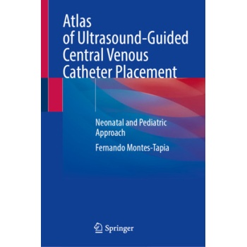 Atlas of Ultrasound-Guided Central Venous Catheter Placement | Fernando Montes-Tapia