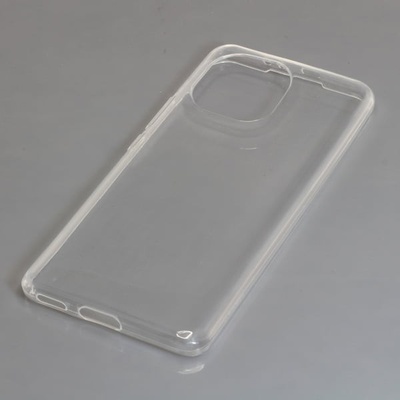 OTB Силиконов калъф за Xiaomi Mi 11, прозрачен (8014424)