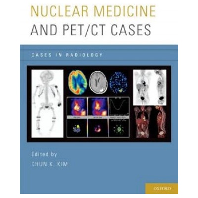 Nuclear Medicine and PET/CT Cases