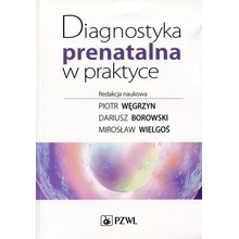 Diagnostyka prenatalna w praktyce