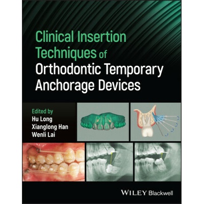 Clinical Insertion Techniques of Orthodontic Tempo rary Anchorage Devices