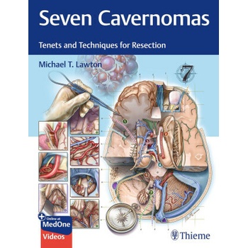 Seven Cavernomas