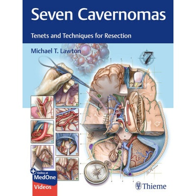 Seven Cavernomas