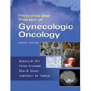 Image 1 of Principles and Practice of Gynecologic Oncology | Dennis Chi, Andrew Berchuck, Don S. Dizon, Catheryn M. Yashar