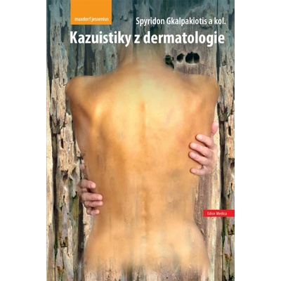 Kazuistiky z dermatologie