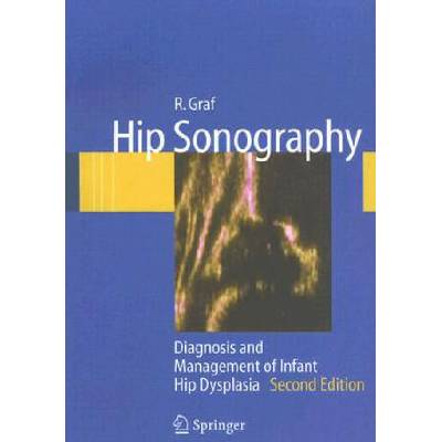 Hip Sonography