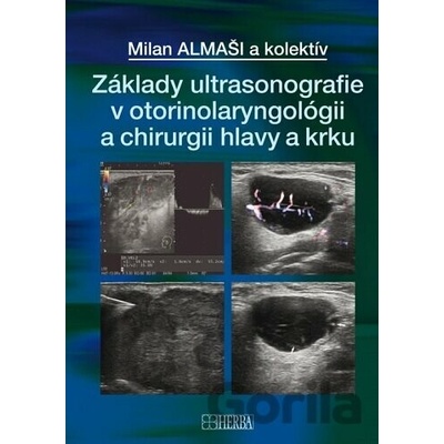 Základy ultrasonografie v otorinolaryngológii a chirurgii hlavy a krku - Milan Almaši