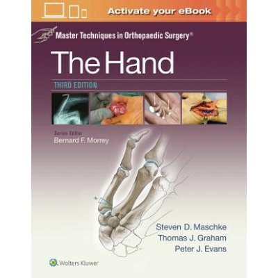 Master Techniques in Orthopaedic Surgery: The Hand - Graham Thomas J.