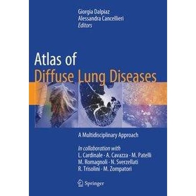 Atlas of Diffuse Lung Diseases - A Multidisciplinary Approach Dalpiaz GiorgiaPevná vazba